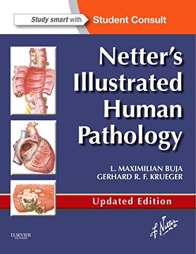 Netter'S Illustrated Human Pathology Updated Edition, With Student Consult Access