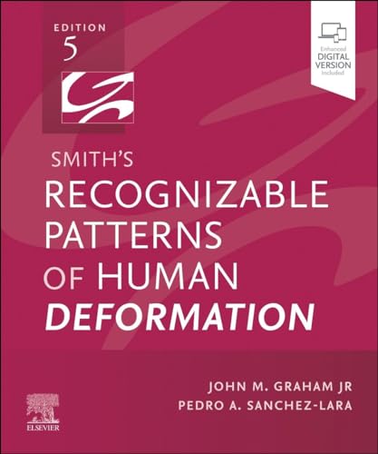 Smith'S Recognizable Patterns Of Human Deformation