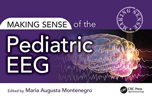 Making Sense Of The Pediatric Eeg