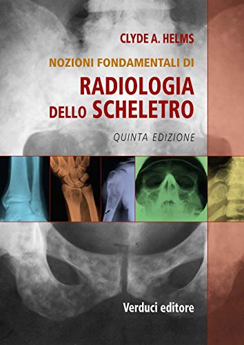 Radiologia Dello Scheletro. Nozioni Fondamentali