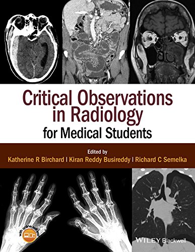 Critical Observations In Radiology For Medical Students (English Edition)