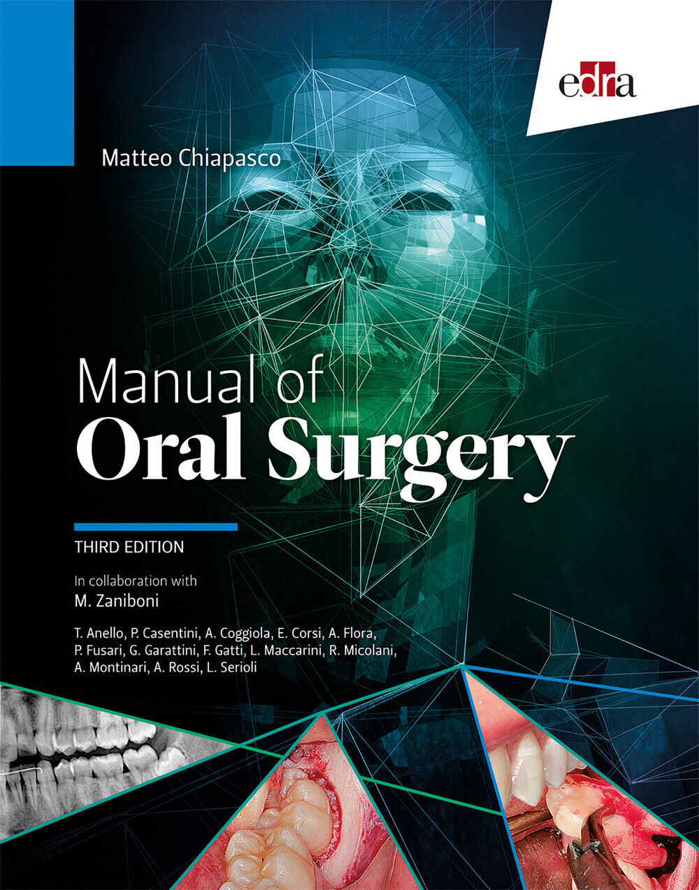 Manual of oral surgery - Chiapasco Matteo