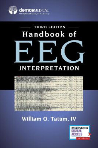 Handbook of EEG Interpretation by Tatum, William O., IV