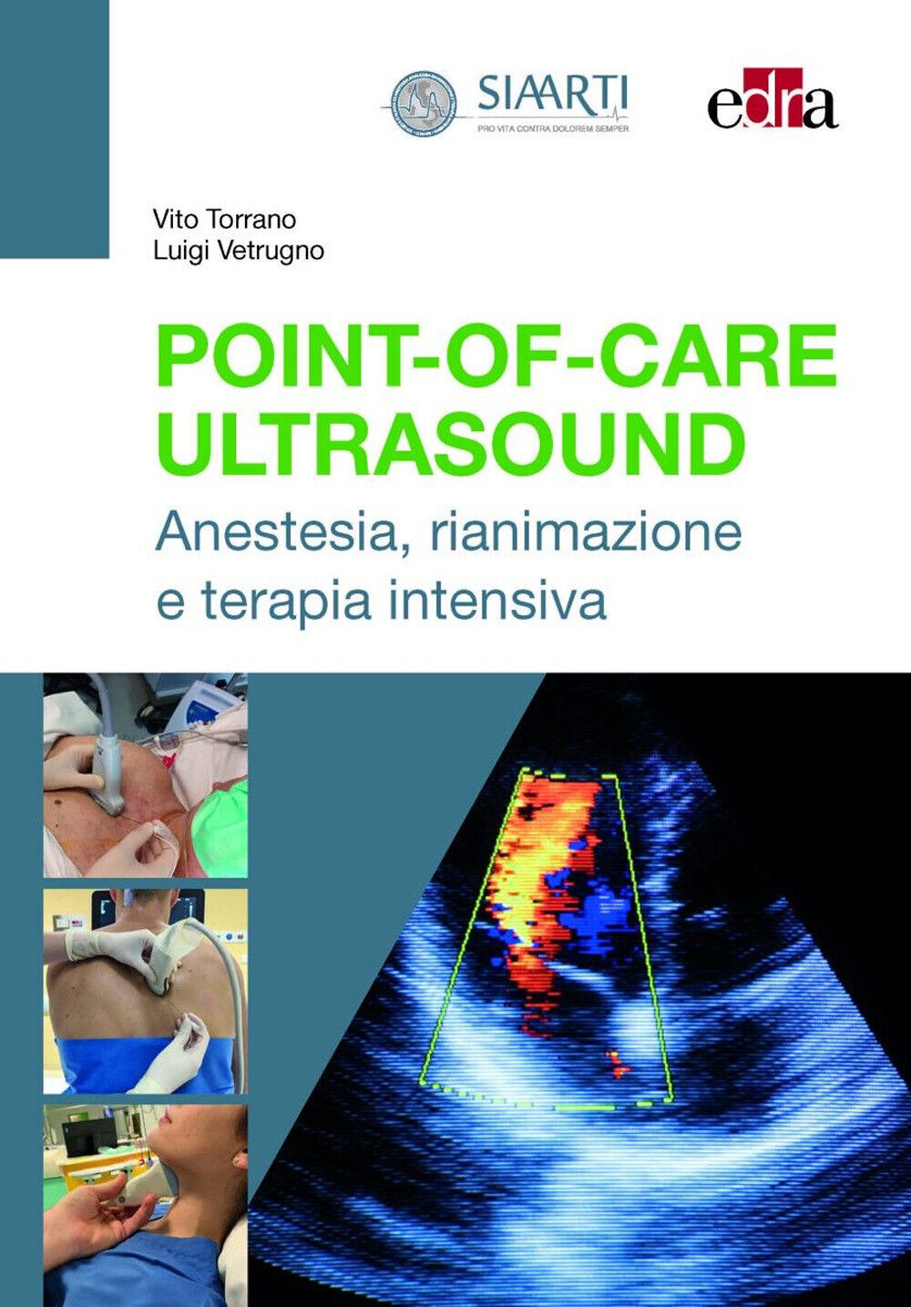 Point-of-Care Ultrasound. Anestesia, rianimazione e terapia intensiva - To...
