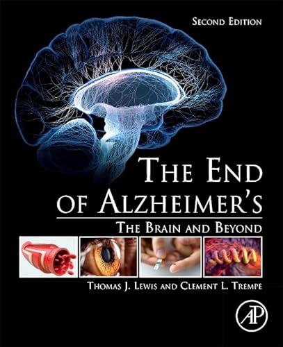 The End Of Alzheimer'S: The Brain And Beyond