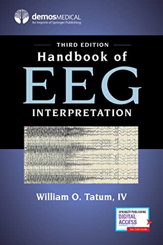 Handbook Of Eeg Interpretation: A Guide To Policy, Programs, And Services