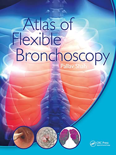 Atlas Of Flexible Bronchoscopy