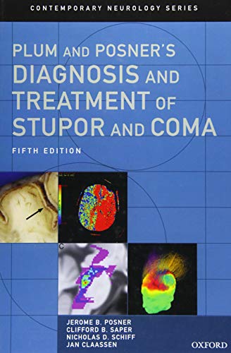 Plum And Posner'S Diagnosis And Treatment Of Stupor And Coma