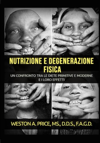 Nutrizione E Degenerazione Fisica