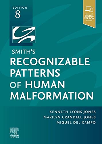Smith'S Recognizable Patterns Of Human Malformation: Expert Consult - Online And Print