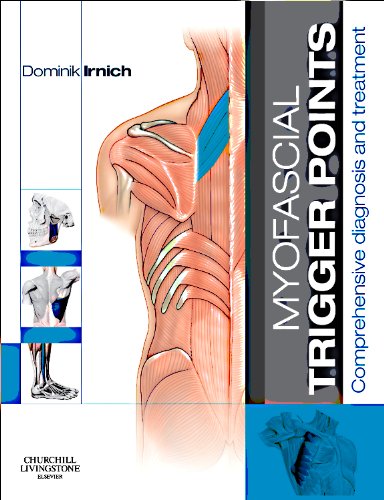 Myofascial Trigger Points: Comprehensive Diagnosis And Treatment