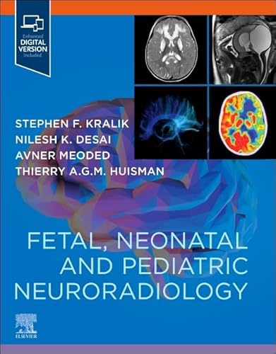 Fetal, Neonatal And Pediatric Neuroradiology