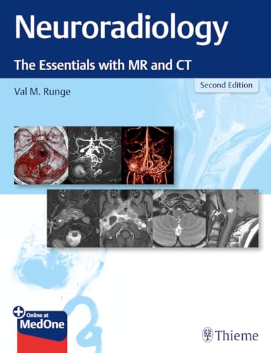 Neuroradiology: The Essentials With Mr And Ct