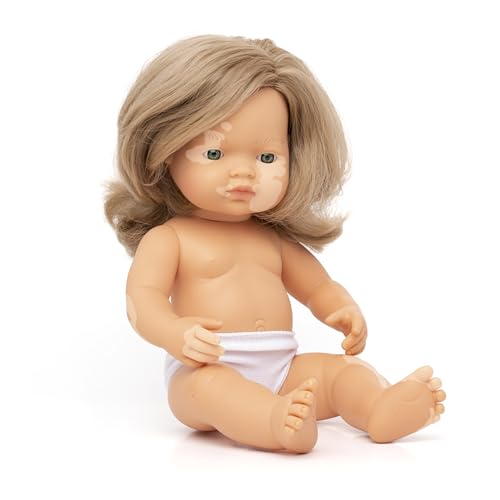 Miniland Doll 15'' Caucasian Girl With Vitiligo (Polybag) - Made In Spain, Anatomically Correct, Inclusion, Quality Toy