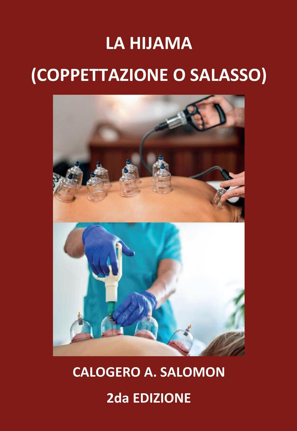 La hijama (coppettazione o salasso) - Salomon Calogero A.