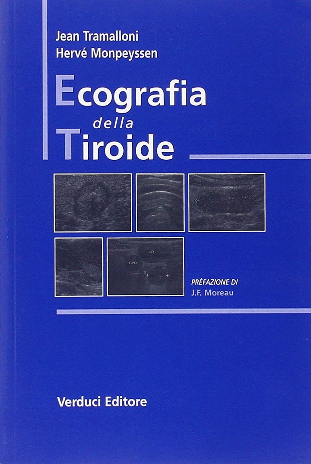 Libri Jean Trammalloni / Hervé Monpeyssen - Ecografia Della Tiroide