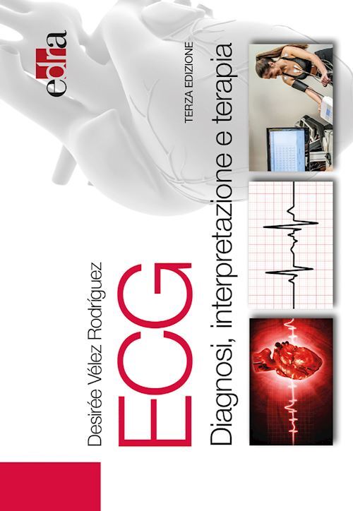 ECG. DIAGNOSI, INTERPRETAZIONE E TERAPIA  - VELEZ RODRIGUEZ DESIREE - Edra