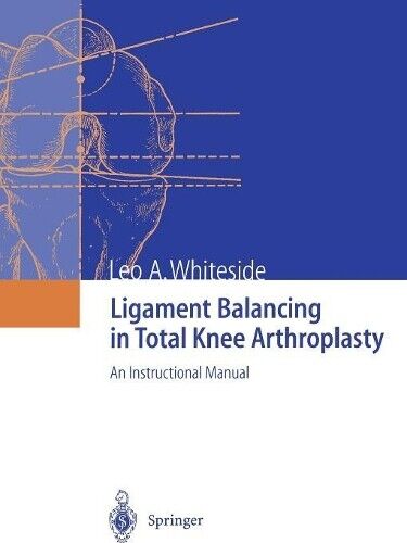 Leo A. Whiteside Ligament Balancing in Total Knee Arthroplasty (Tascabile)