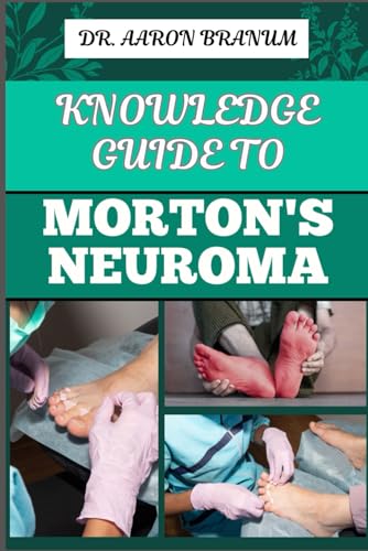 Knowledge Guide To Morton’S Neuroma: Essential Manual To Symptoms, Diagnosis, Treatment, And Pain Relief For Foot Health And Nerve Pain Management
