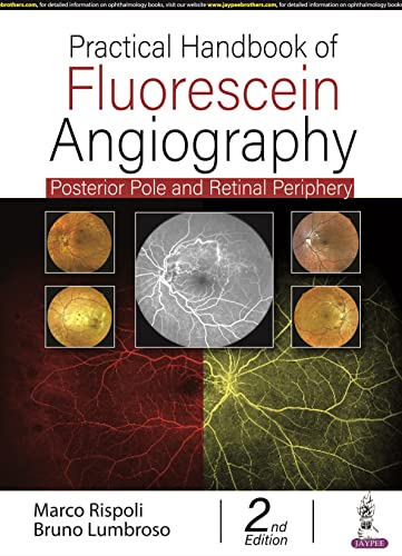 Practical Handbook Of Fluorescein Angiography: Posterior Pole And Retinal Periphery