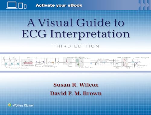 A Visual Guide To Ecg Interpretation